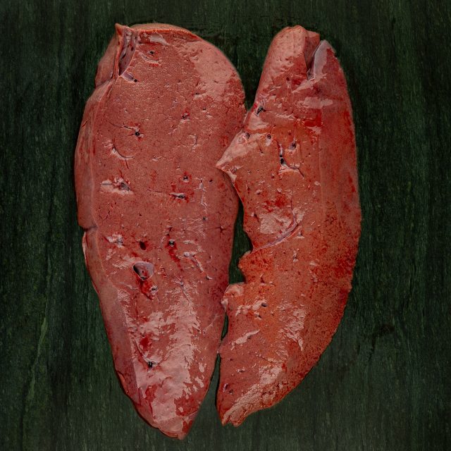 🥩 Φρέσκο Συκωτάκι – Θρεπτική και Γευστική Απόλαυση! 🥩

Αναζητάτε μια γευστική και θρεπτική επιλογή για το τραπέζι σας; Το φρέσκο συκωτάκι από το Deka Meat House είναι η ιδανική επιλογή! Πλούσιο σε σίδηρο και βιταμίνες, προσφέρει μια γεύση που ξεχωρίζει.

🔔 Μην το Χάσετε: Ελάτε στο κατάστημά μας και προμηθευτείτε το. 
__________________
#ΦρέσκοΣυκώτι #ΘρεπτικήΔιατροφή #10meathouse_official #dekavari #deka #meathouse #deli #delicatessen #athens #vari #athensfood #meatlovers #delistories #freshmeat #familystore